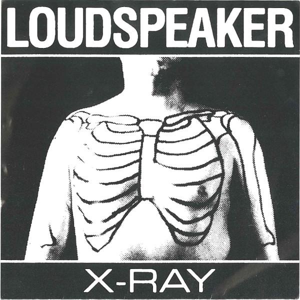 Loudspeaker - X-Ray